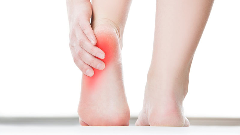 Sakit pada Tumit Kaki Saat Pagi Hari: Jangan Remehkan, Ini Mungkin Tanda Plantar Fasciitis – PAFI Kota Jambi